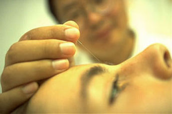 Acupuncture treats the core issues for complete healing and healing energy flow